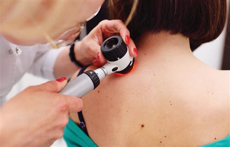 How Does A Dermatologist Check For Skin Cancer?
