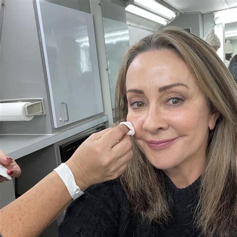 Patricia Heaton Face Surgery