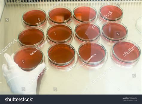 92 Eosin methylene blue agar Images, Stock Photos & Vectors | Shutterstock