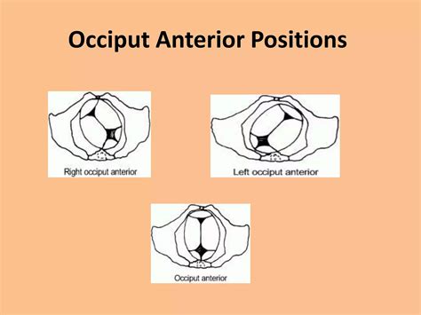 Malpresentations&malpositions | PPTX