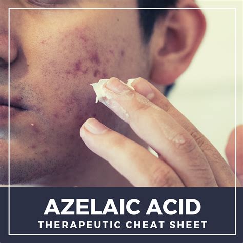 Finacea Azelaic Acid For Melasma at Glenda Macon blog