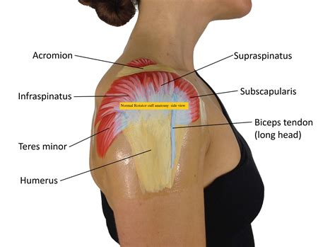 Rotator Cuff Injuries – Physiocure, Santacruz