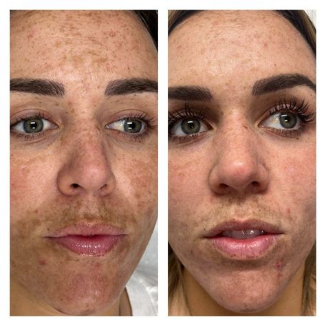 Eros Beauty and Wellness | #1 Medical Spa in San Diego