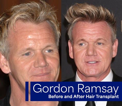 Gordon Ramsay Antes E Depois
