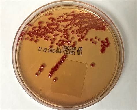 What Causes Serratia Marcescens Bacteria at Molly Lowes blog