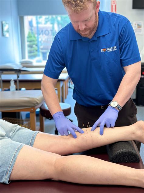 Discovering the Benefits of Dry Needle Treatment - Houghton Physical Therapy