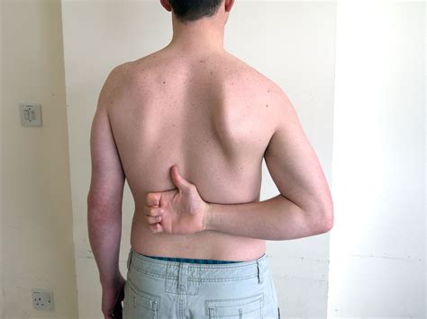 Shoulder Examination — Medistudents
