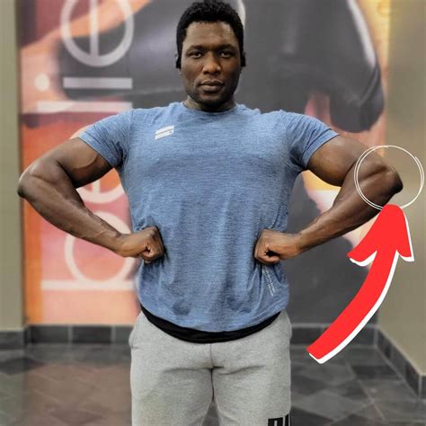 Elbow Pain Caused By Lifting Weights at Ellie Roseby blog