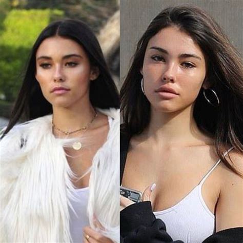 Madison Beer plastic surgery | Madison beer plastic surgery, Madison ...