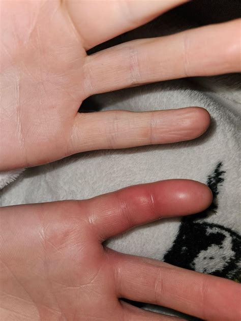 For those wondering how much a centipede sting hurts: here you go : r/centipedes