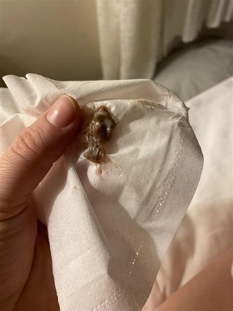 Thick Rubbery Mucus From Nose