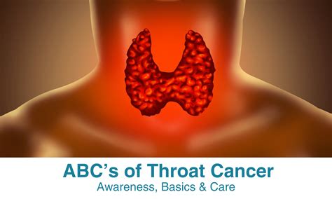 El ABC del cáncer de garganta: concientización, conceptos básicos y ...