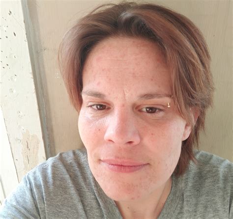 Horror pit bull attack leaves woman with multiple amputated limbs