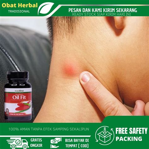 Neck Lumps Medicine, Neck Lumps Remover, Thyroid Gland Medicine, Hyperthyroid, Lymph Nodes ...