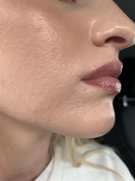 [Routine Help] Dehydrated skin? : r/SkincareAddiction