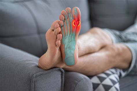 Turf toe: What athletes need to know about this painful injury | Orthopaedics | UT Southwestern ...
