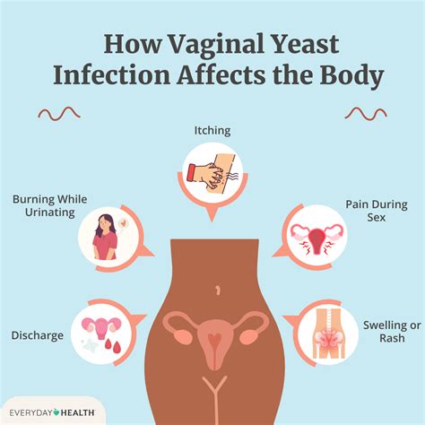 Bacterial Vaginosis May Be Sexually Transmitted, Study Finds - sex with yeast