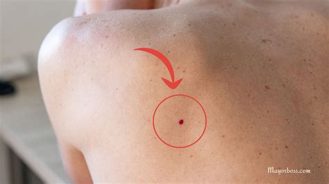 What It Means When You Have Little Red Dots on Your Skin | Red skin spots, Red spots on face ...