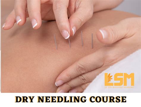 MYOFASCIAL DRY NEEDLING COURSE - Le Spa Massage Academy