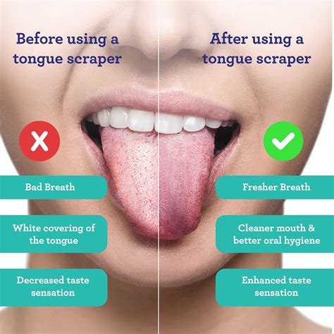 Gurunanda's U-Shaped Stainless Steel Tongue Scraper, 2 Count | Tongue ...
