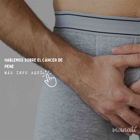 Cáncer de pene, raro pero letal - Manatí