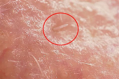 These nipple mites have sex on your face as you sleep