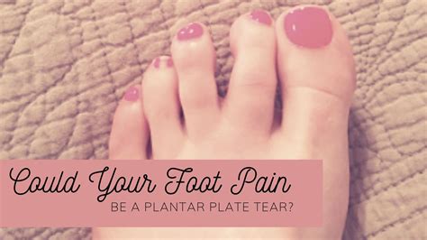 Plantar Plate Tear- Causing Pain Under The Ball of Your Foot. - Well ...
