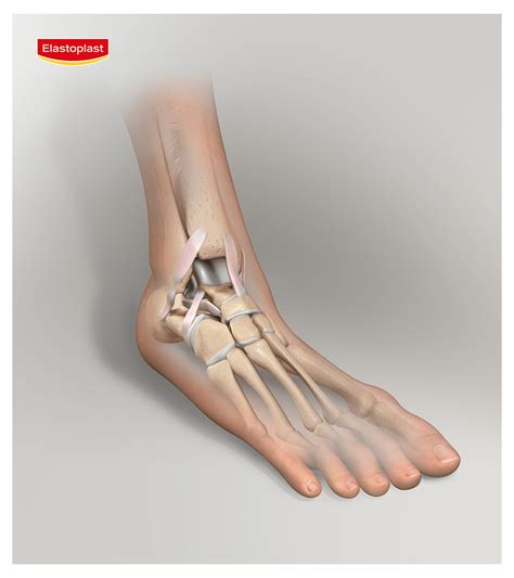 Dislocated Ankle Recovery Time | Elastoplast UK