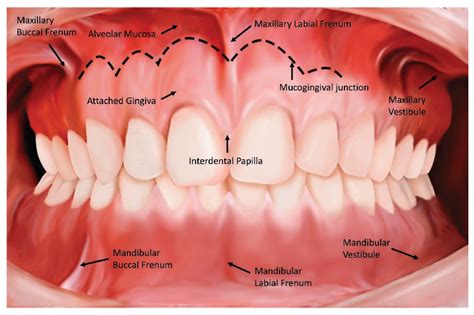 Morphology of the Labial Frenum by Age-Cohort: A Cross-Sectional Study[v1] | Preprints.org