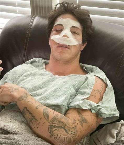 Tayler Holder Talks Bike Accident and Addresses Rumors (Exclusive)