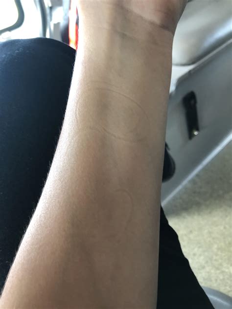 Lines On My Arms