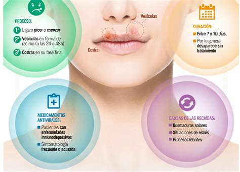 Fuego labial por estrés: causas, síntomas y prevención