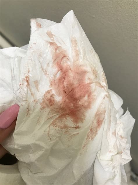 Implantation Bleeding Look Like