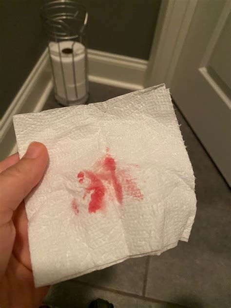 Implantation Bleeding Small Clots Is This Implantation Bleeding