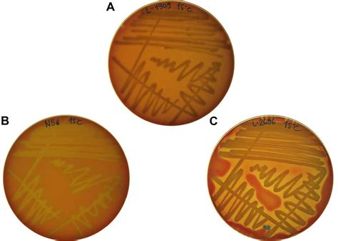 Blood Agar Alpha Hemolysis