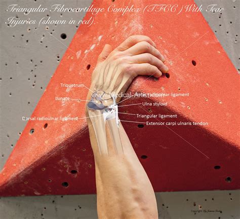 The Climbing Bible - Managing Injuries - Medical Artist
