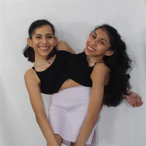 Conjoined Twin Carmen Andrade, Husband Daniel McCormack Slam Critics “Obsessed” With Sex Life ...