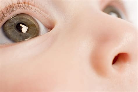 Baby Eye Ointment At Birth
