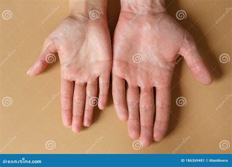 Male Vs Female Hand Anatomy at Nancy Merrell blog