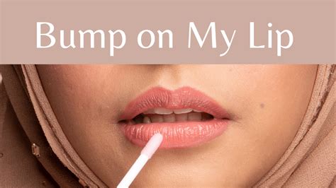 Why Do I Have a Bump on My Lip? - HealthNord