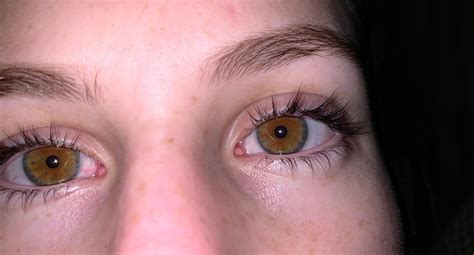 Brown Eyes With Blue Ring Around Iris