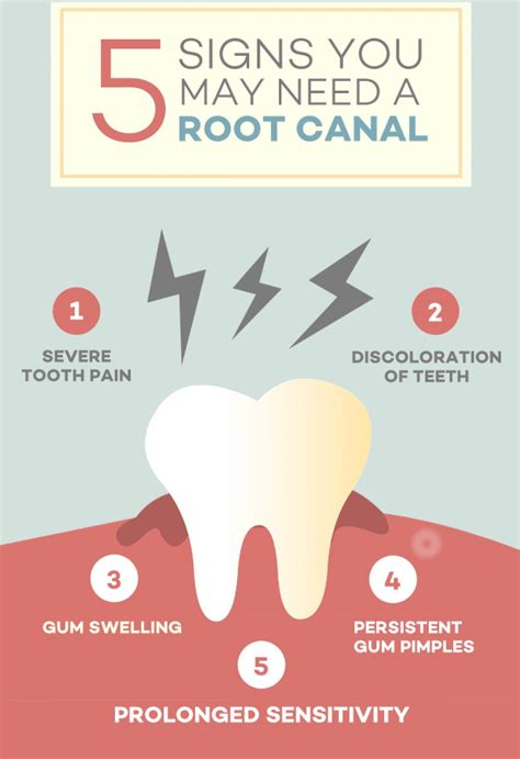 Root Canal Awareness Week | Your Dentists in Asheville, NC