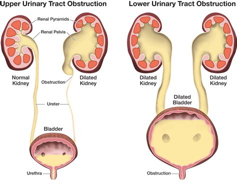 Anatomy Of Urinary Track