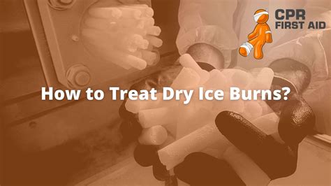 Dry Ice Burn En Poured Into Fire, Some Powdered Detergents Can Produce