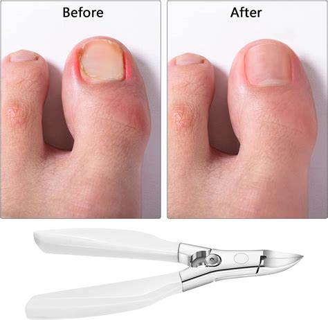 Professional Toe Nail Clipper for Ingrown and Thick Toenails ...