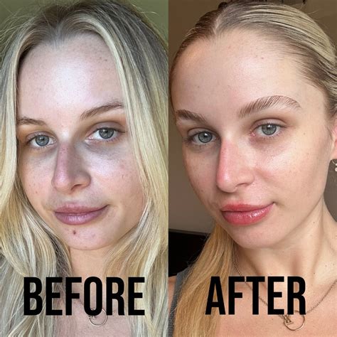 Olay Super Serum Review With Photos | PS Beauty