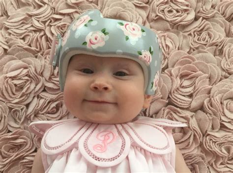 why are some babies wearing helmets - Book Chronicle Ajax