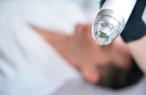 Is Rosacea Autoimmune? | Watson Dry Eye Clinic