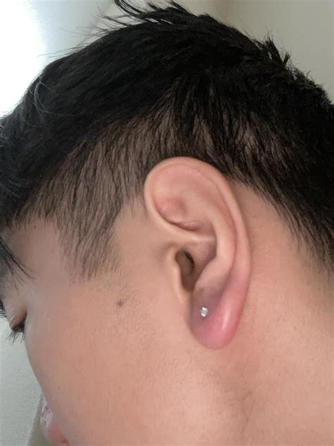 Earlobe infection, serious or not? : r/piercing