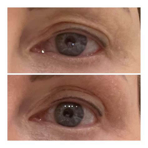 Eye Lift Wand – Topical Eye Lift Treatment Serum | SBLA Beauty